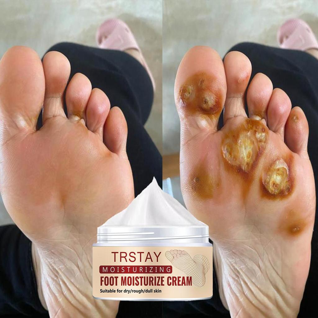 Nourishing Hand And Foot Mask Set With Moisturizing Foot Cream, For Smooth And Glowing Skin