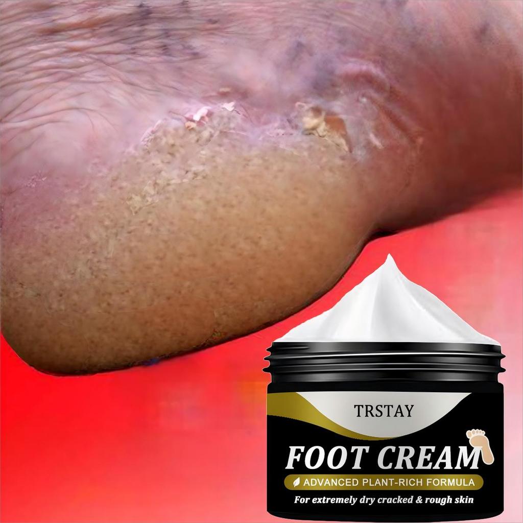 Foot Moisturizing Cream är rik på växter och kan användas flexibelt för torr, sprucken och sträv hud. Fotfuktande kräm