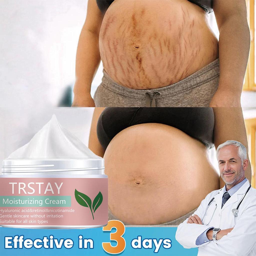 Gentle and Non-irritating, the Smoothing Skin Stretch Mark Cream Smooths Wrinkles, Fades Fine Lines, and Leaves Skin Soft and Refined