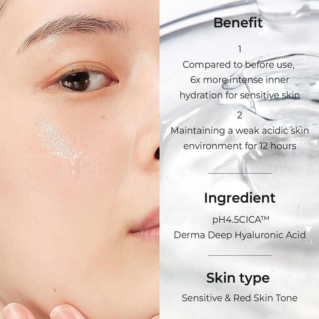 Aestura A-Cica 365 Calming Toner Set (200ml + 50ml) - [K-BEAUTY] Gentle Exfoliating & Soothing - Ex.2026.10.23