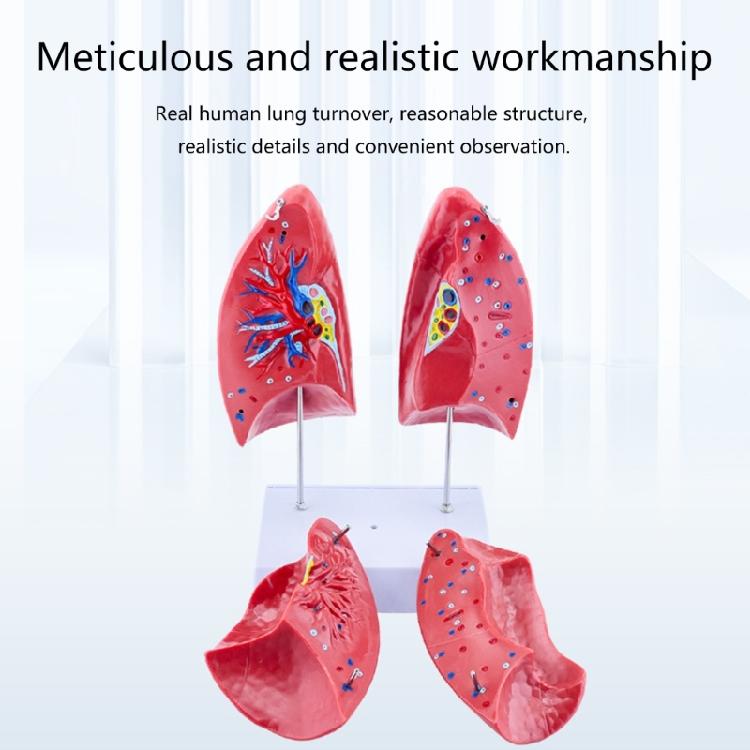 Anatomical Human Lung Model with Removable Parts Lung Anatomy Model Normal Lung Anatomy Model for Teaching Demonstration