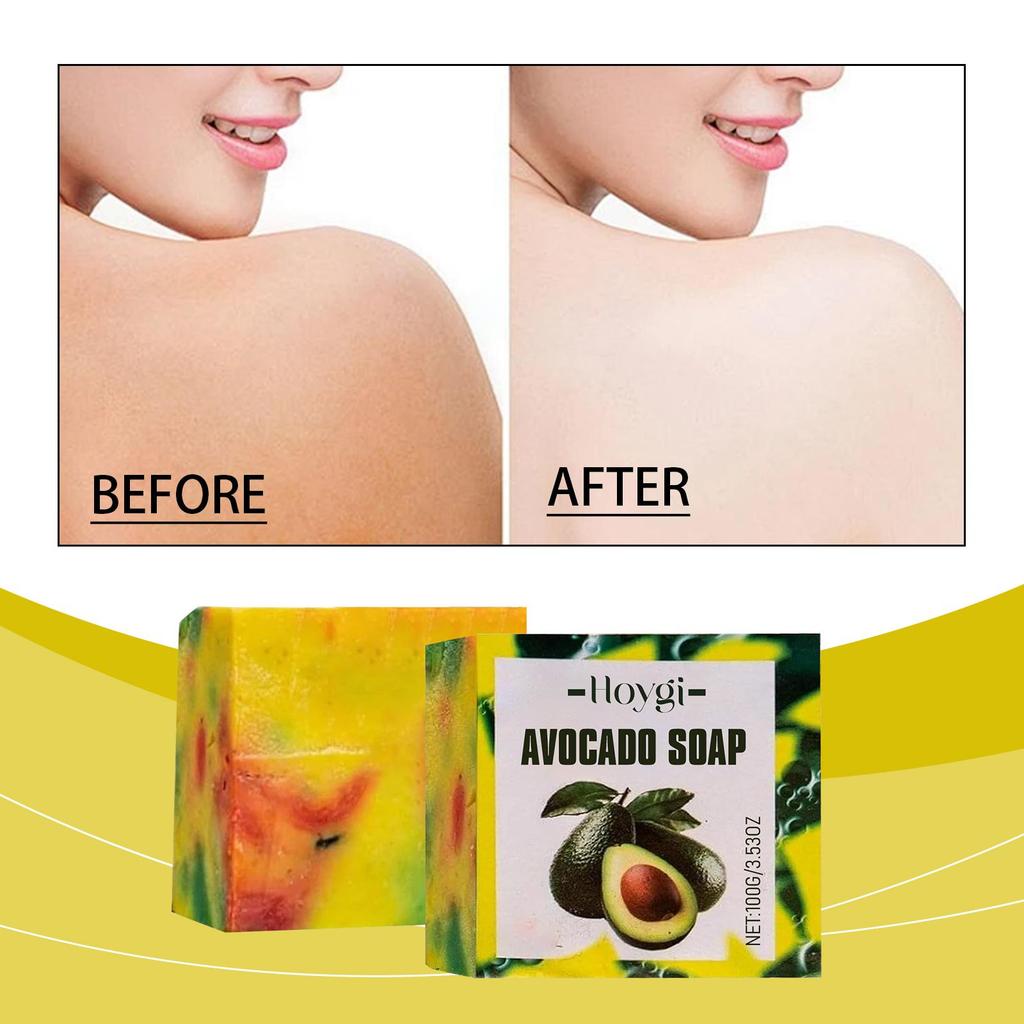 Sapone Solido Idratante all'Avocado per Donne Uomini, Detergente Delicato Idratante, Pulizia Profonda dei Pori, Riequilibra la Pelle Grassa, Pelle Fresca Morbida