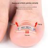 Bionic Nickel-Titanium Alloy Nail Corrector with Double Wings for Ingrown Nail, Nail Groove, and Curl Correction; Invisible and Adjustable.