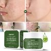 Acne Removal Cream Whitening Fade Spots Acne Scar Remedy Remover Cream Pimple Scar Repair Shrink Pore Skin Care Treat