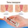 Hemorrhoid Ointment Hemorrhoid Care Cream Ointment For Male And Female Internal And External