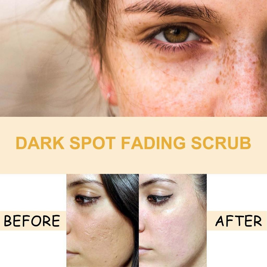 Eelhoe Turmeric Skincare Set For Brightening And Hydrating With Cleansing Exfoliating Creams