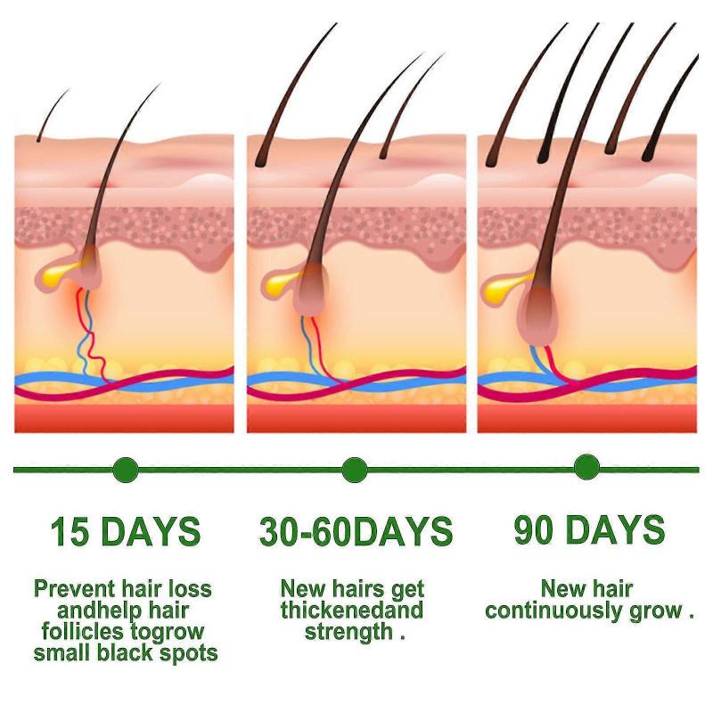 2 Pack Rosemary Oil For Hair Growth Rosemary Essential Oil For Skin & Hair Care Hair Strengthening Oil For Fuller Healthier Hair Perfect For Aromather