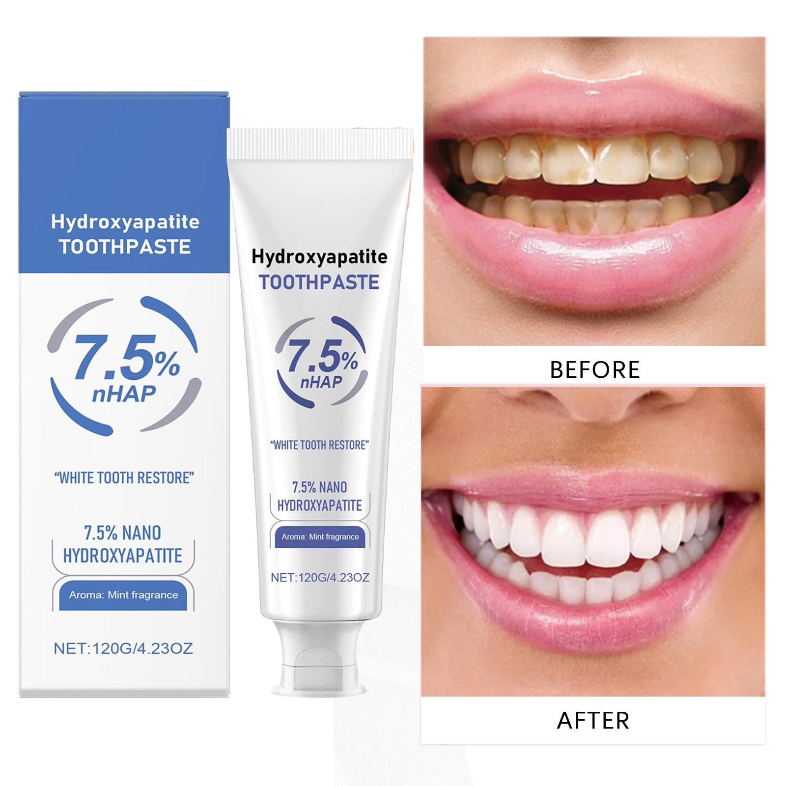 

Зубна паста з гідроксиапатитом Відбілююча зубна паста, свіжість, подих, зубна паста, зубна паста, видалення плям, повний догляд за зубами 120 г синій