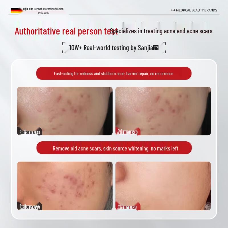 BEAI Salicylic Acid Acne Repair Cream