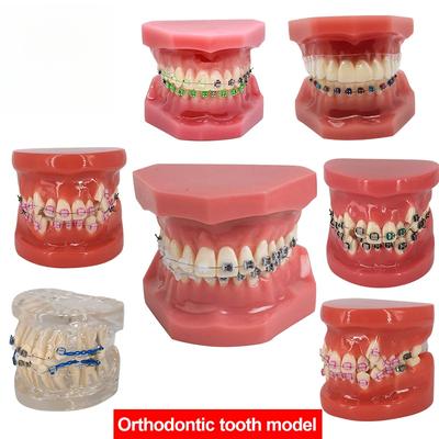 Dental Model With Braces Dentistry Materials Orthodontic Models Gum Tooth Teeth Model For Studying Teaching Patient Education