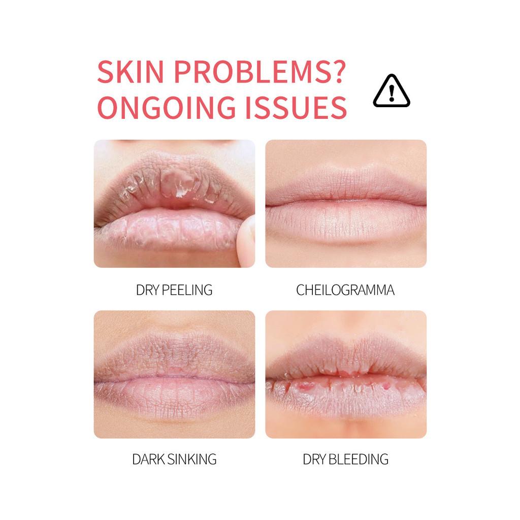 8pcs/4pcs Box Fruits Lip Balm Sets Moisturizing Lipstick Makeup Base Moisturizer Lip Balm Anti-Cracking Lips Skin Care