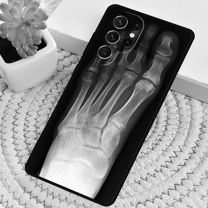 X-Ray Human Anatomy TPU Phone Case For Samsung Galaxy Note 10 Pro S26 S25 S24 S23 S22 Ultra Plus S21 FE S20 Shockproof Cover