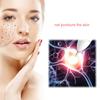 177---50/100pcs surgery sterile needle small mole removal pen needle mole freckles and other machine accessories