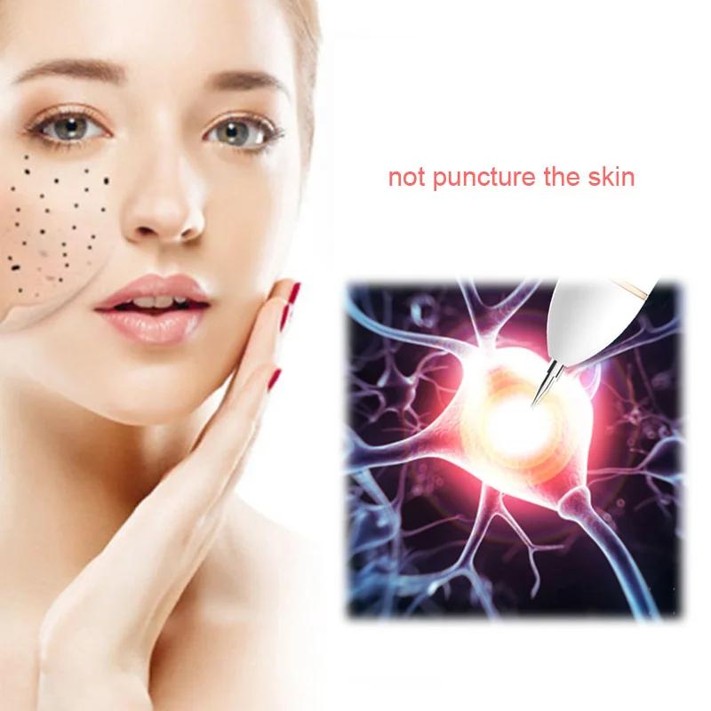 177---50/100pcs surgery sterile needle small mole removal pen needle mole freckles and other machine accessories