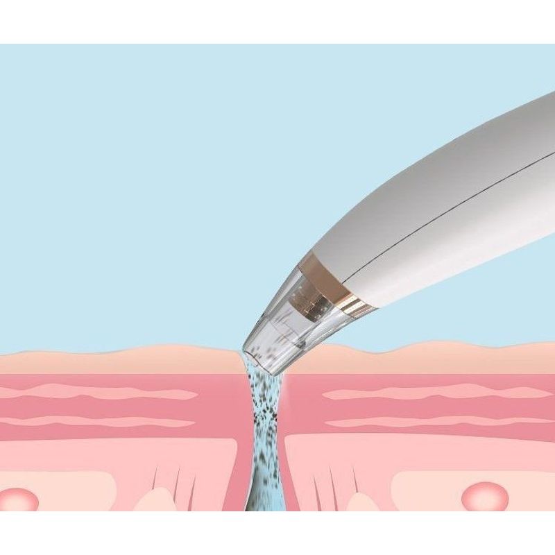 Thalia - Blackhead Remover - USB Rechargeable