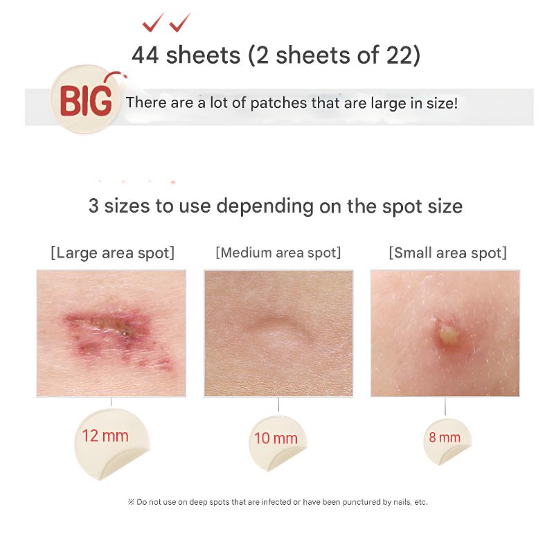 [Elizavecca] Witch Piggy Hell-Pore Blemish Spot Patch (44EA)