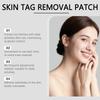 SOUTH MOON Skin Care Patch Lightweight Breathable Acne Patch Face Pimple Treatment for Smooth Skin 36pcs