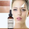 Retinol Face Serum Remove Wrinkle Essence Anti Aging Firming Hyaluronic Acid Moisturizing Nourishing Whitening Facial Skin Care