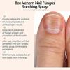 Bee Venom Nail Repair Serum, Nail Care Solution, Natural Bee Venom Nail Care Spray, Ingrown Toenail Care Spray