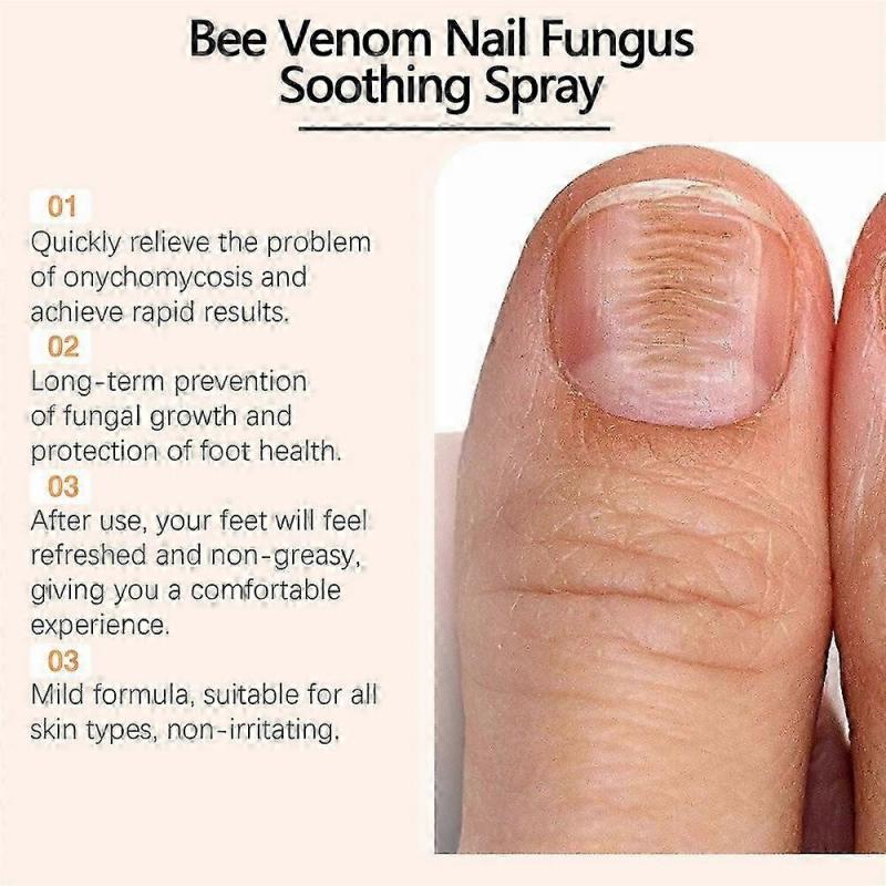 Bee Venom Nail Repair Serum, Nail Care Solution, Natural Bee Venom Nail Care Spray, Ingrown Toenail Care Spray