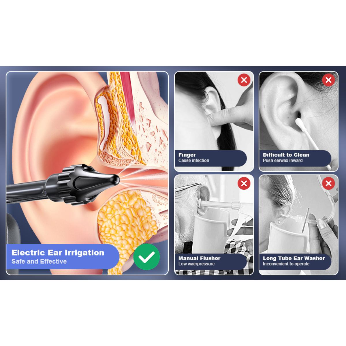 Набор для чистки ушей — фото 9