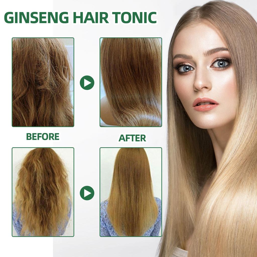Ginseng Hair Growth Lotion Ginseng Essence Moisturizes Hair Prevents Hair Loss  Firms Hair Hair Growth Spray