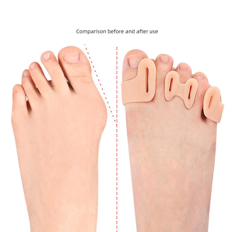 2Pcs=1Pair Hard Silicone Toe Finger Separator 5 Hole Hallux Valgus Orthopedic Spacers Bunion Overlapping Hammer Foot Corrector