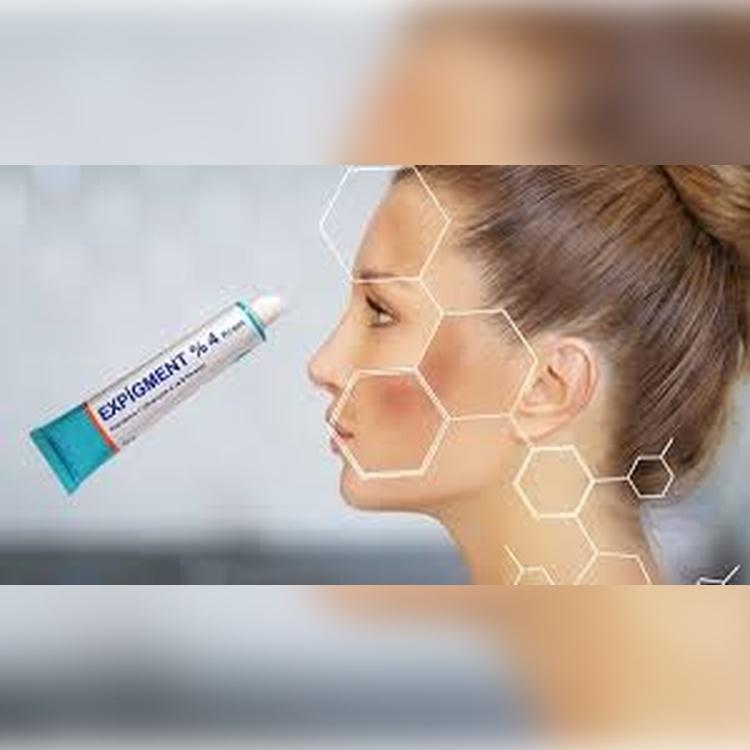 EDLP Cream Expigment 2% / 4% – Skin Lightening Cream