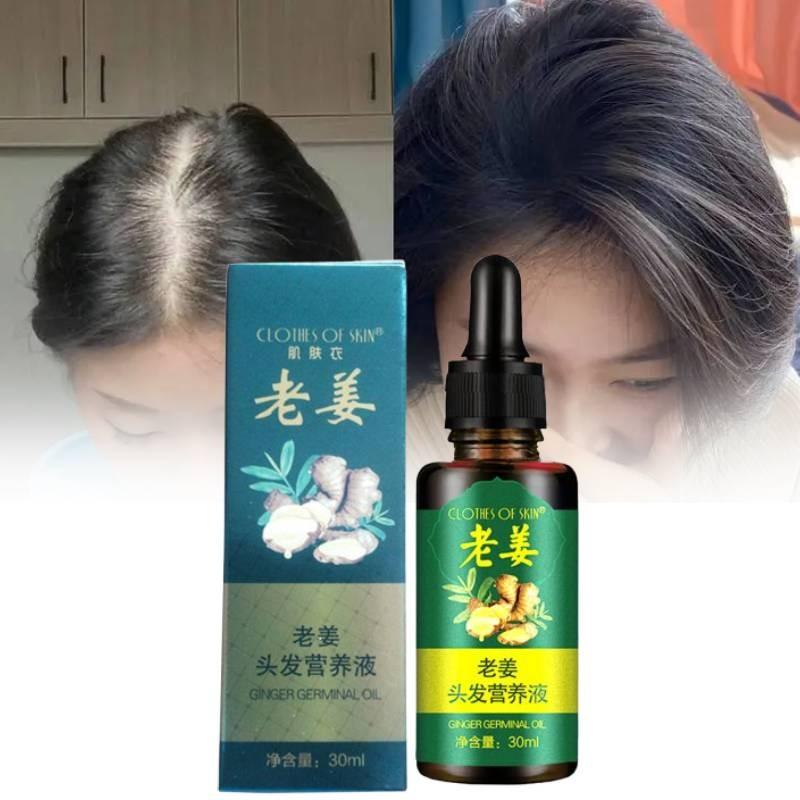 Nourishing Ginger Hair Essence For Healthy And Shiny Locks With Oil Control Benefits