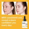 Niacinamide Serum- Deeply Hydrates and Moisturizes, Brightens and Reduces Dark Spots - Suitable for all Skin Types, 50ml