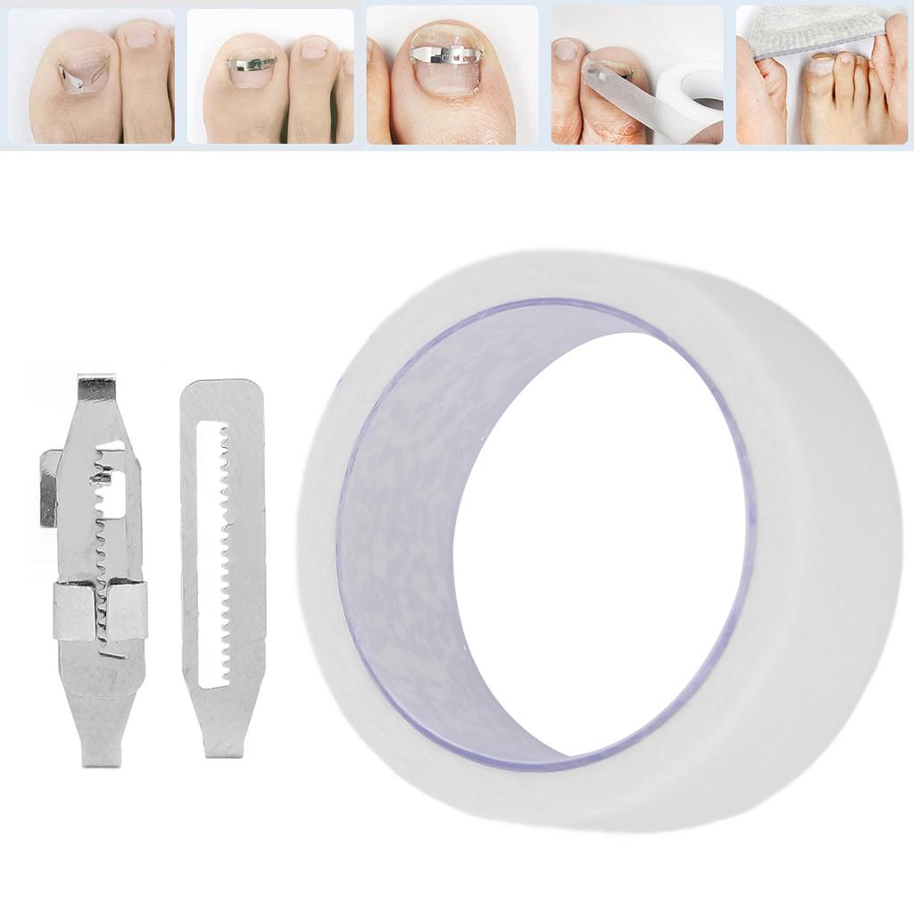 Ingrown Toenail Corrector Stainless Steel Paronychia Correction Tool with Adhesive Tape for Toenail Correction