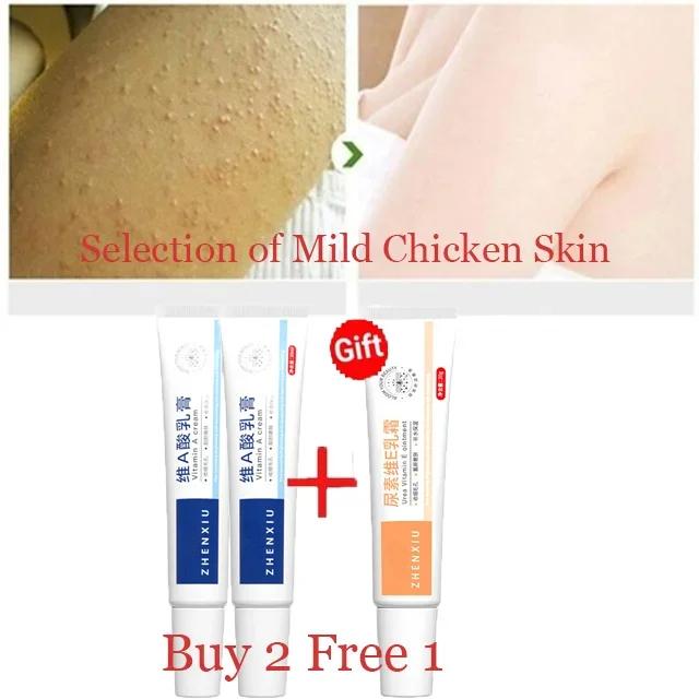 Body Whitening Cream Keratosis Pilaris Treatment Bumpy Rough Chicken Follicle Skin Repair Strawberry Legs Removal Dry Skin Care