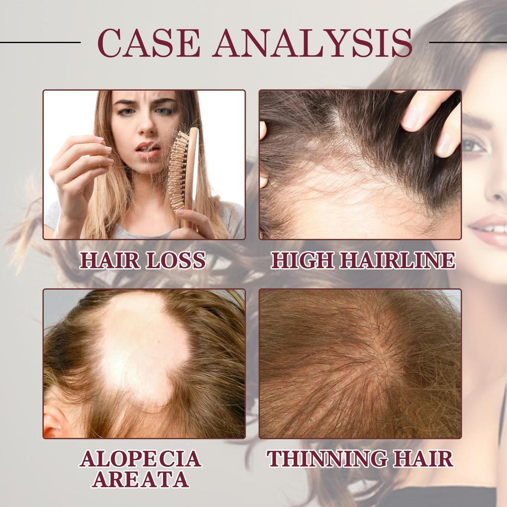 Red Onion Hair Growth Essential Oil Hair Care Spray Nourish Hair Roots Improve Hair Texture Hair Care Products