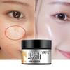 The Latest Horse Oil Freckle Cream, Fade, Stain, Sunburn, Chloasma, Freckles, Facial Care