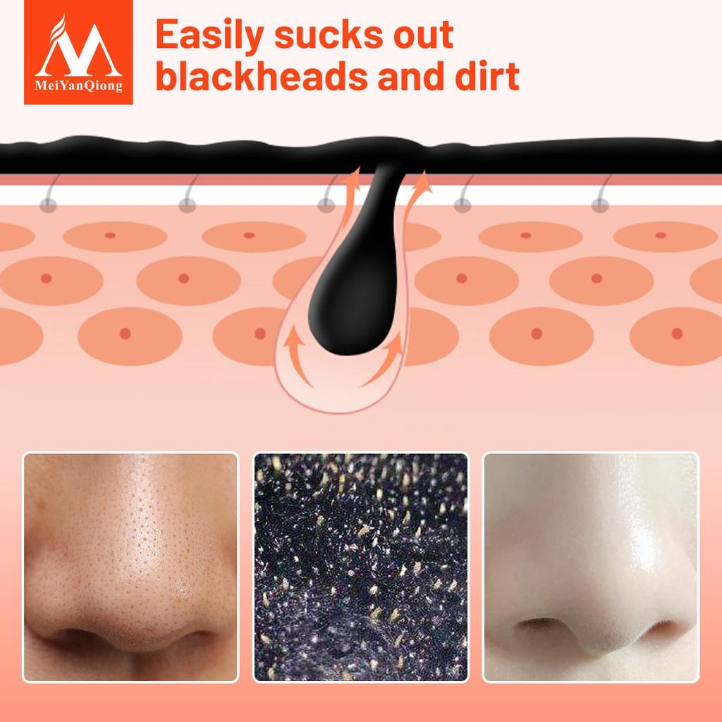 Volcanic Mud Black Mask Face Care Acne Blackhead Removal Treatment Whitening Moisturizing Skin Care Peel Mask Anti-Aging Cream