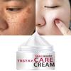 Facial Freckle Cream Targets Black Spots and Irregular Pigmentation To Reduce Black Spots  Skin Whitening, Moisturizing