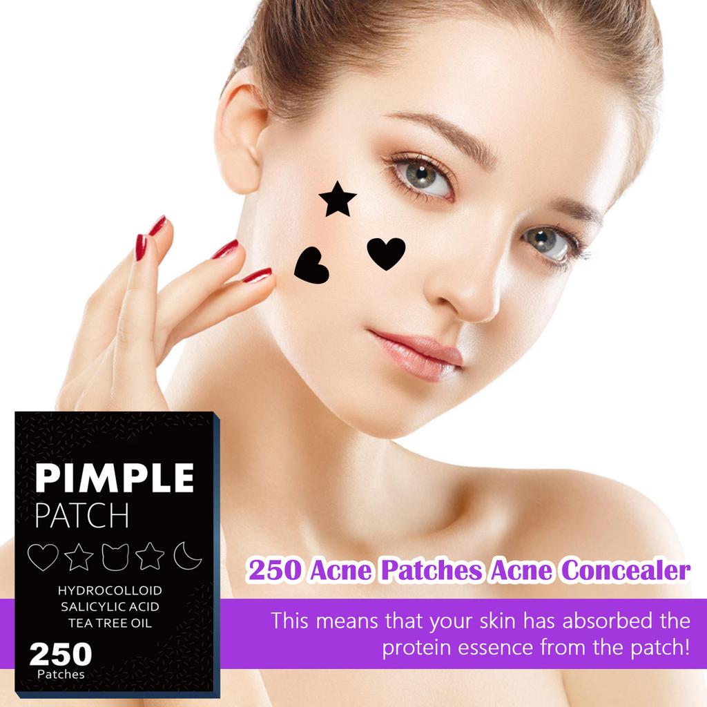 250 Acne Patches Acne Concealer To Fade Acne Patches