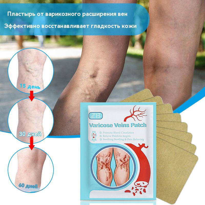 12pcs/Bag Varicose Veins Stickers Varicose Vein Healing Patch Plaster Promote Blood Circulation