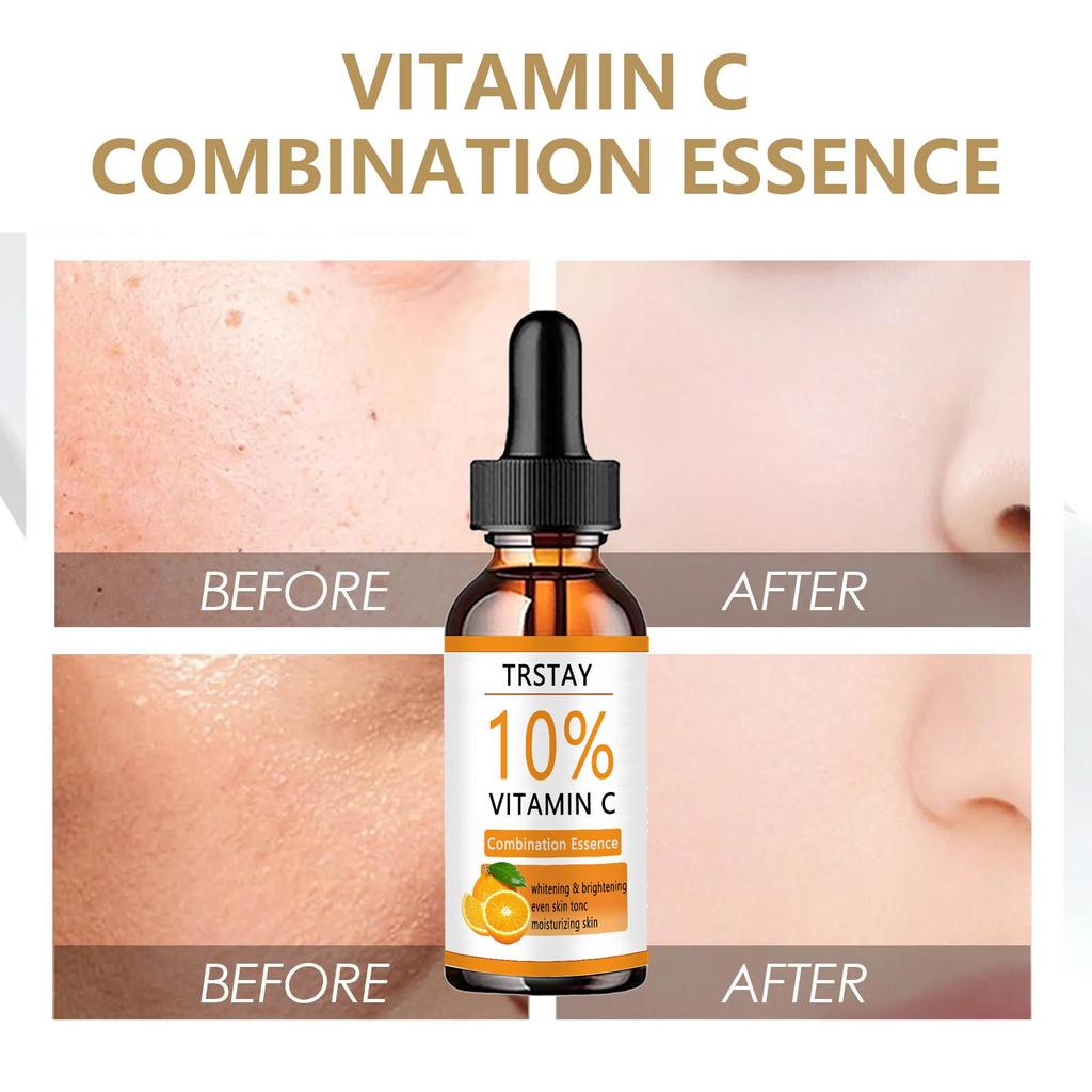 Moisturizer for neck and décolleté, double chin reducer, skin tightening cream  skin whitening cream