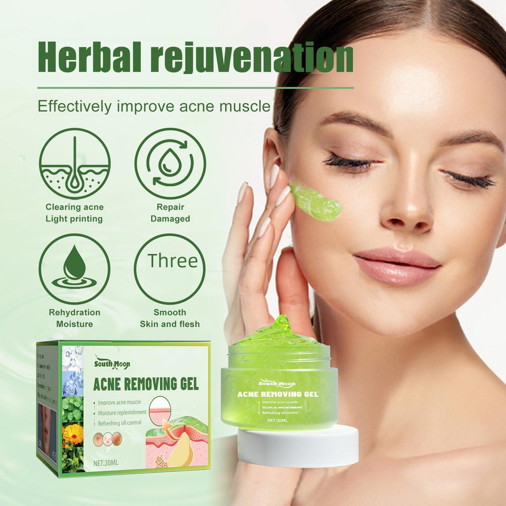 South Moon Acne Gel For Clear And Radiant Skin 30ml Blemish Reducing Formula