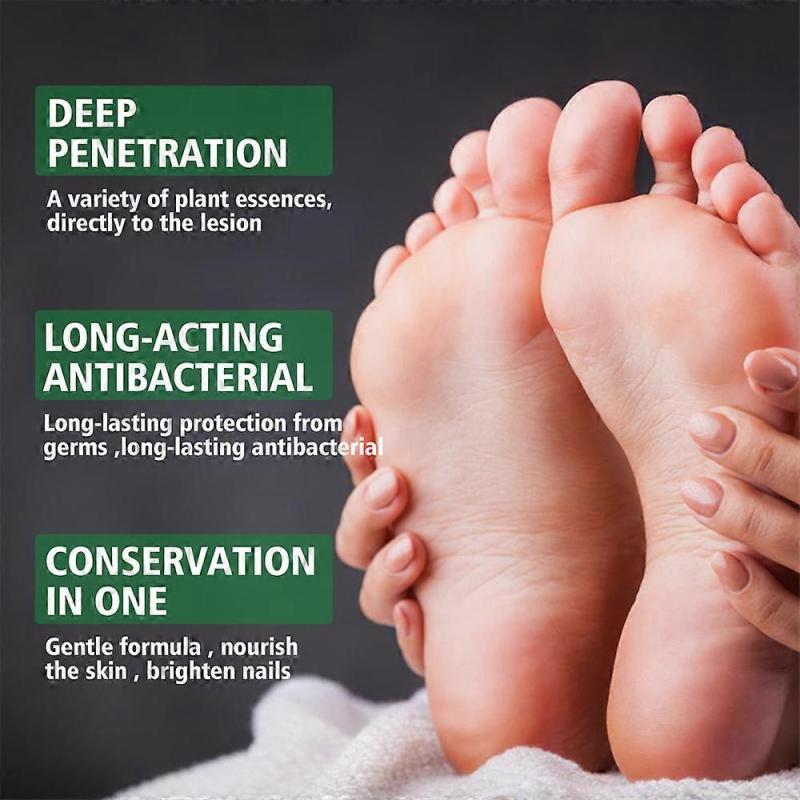 Athletes Foot Spray,Athletes Foot Treatment Spray,Foot Fungal Treatment,Athletes Foot Remedies,Effective Foot Odour Spray