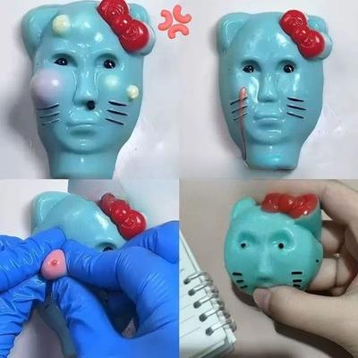 1Pcs Funny Pimple Popper Acne Relief Toy Reusable Low Rebound Decompression Toys Unique Home Decoration Friend Birthday Gift