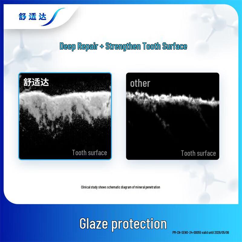 Sensodyne Rapid Relief Toothpaste