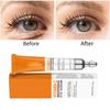 Vitamin C Brightening Eye Serum For Dark Circles Puffiness And Fine Lines In 20ml