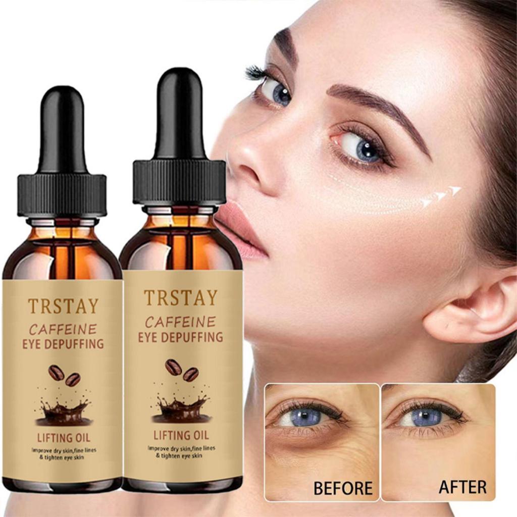 Aufhellende Creme zum Entfernen dunkler Flecken, Gesichtscreme gegen Sommersprossen, Creme zum Entfernen von Melasma und dunklen Flecken, aufhellende Creme zum Entferner