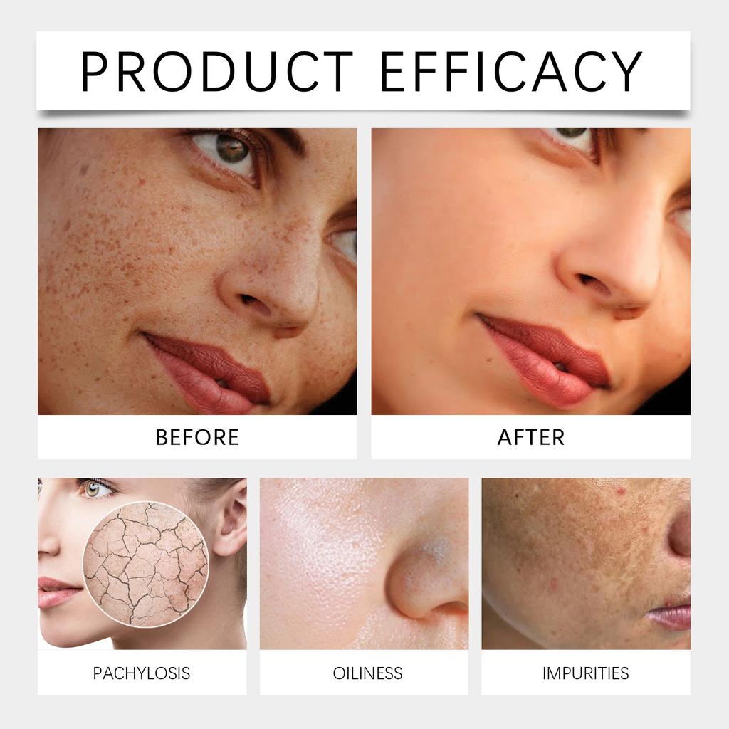 Hyaluronic Acid Moisturizing Serum Nourishing Moisturizing Soft Moisture Easily Absorbed Refreshing Serum