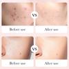 Luxury Rose Essence Anti-aging Skin Care Set Hyaluronic Acid Hydrating Anti-wrinkle and Freckle Six-piece Set