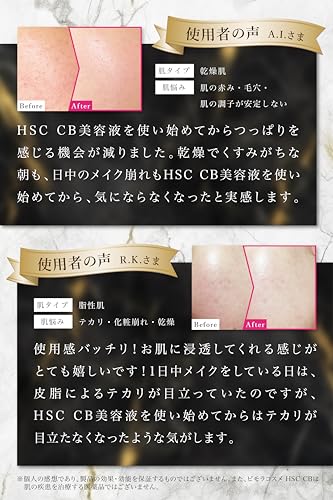 BimoRa HSCCB Serum, Human Stem Cells, High Concentration, Anti-Aging Care, Moisturizing, Exosomes, Made in Japan, 30ml
