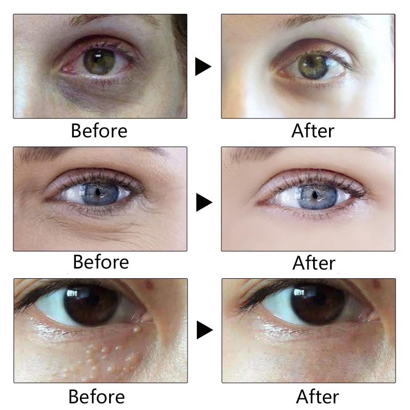 Eye Cream Peptide Collagen Serum Anti-Wrinkle Anti-Age Remover Dark Circles Eye Care  Eye Creams