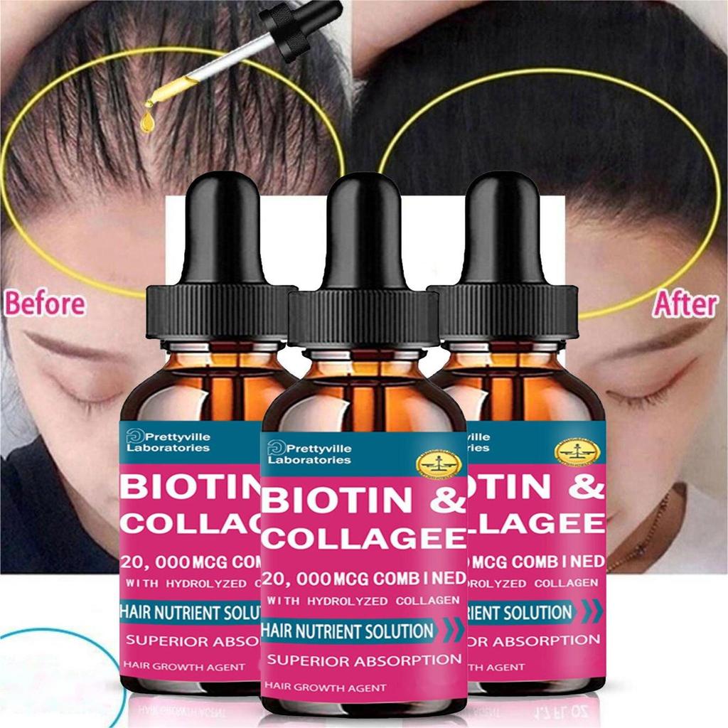 Indian Mysterious Formula Hair Growth Oil for Women Men Hair Grow Spray Fast Anti Hair-loss Head Skin Care
